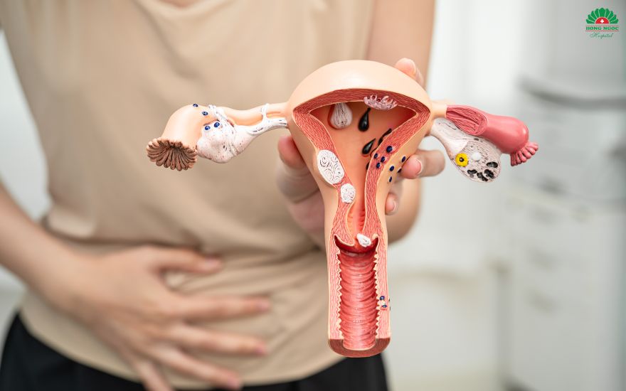 Gynecologic cancer is a group of malignant diseases that develop in the female reproductive organs.