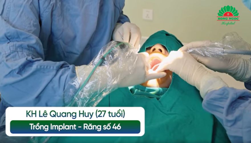 khách hàng trồng răng Implant