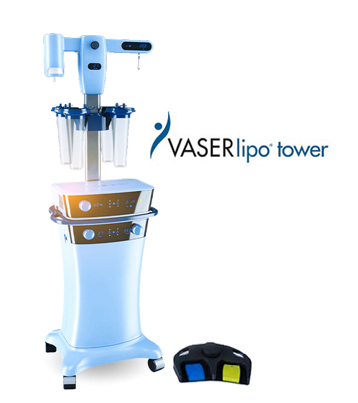 hút mỡ Vaser Lipo