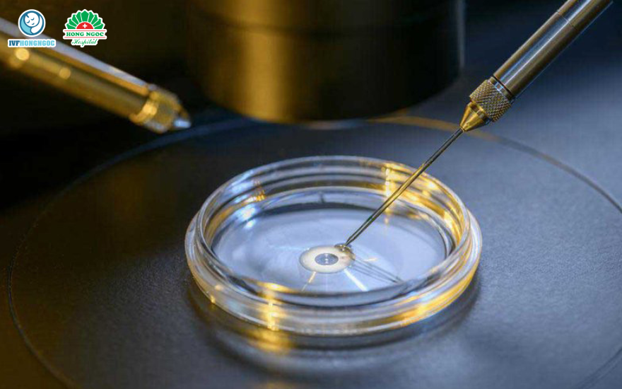 Phương pháp thụ tinh ống nghiệm IVF thường quy