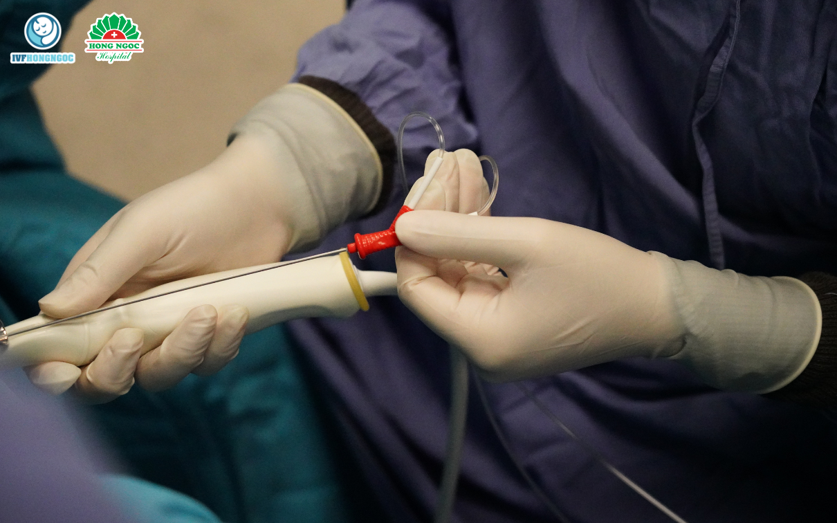 IVF Hồng Ngọc sở hữu các kỹ thuật hỗ trợ sinh sản tiên tiến, hiện đại