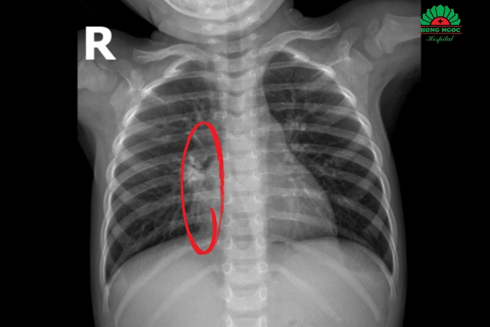 Khoa Nhi   Ngọc (4)