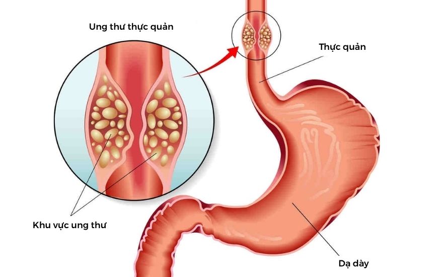 Thanh Thùy ảnh Bài Web (880 X 550 Px) (5)