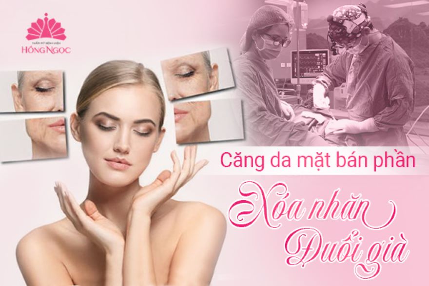 Cang Da Mat Ban Phan
