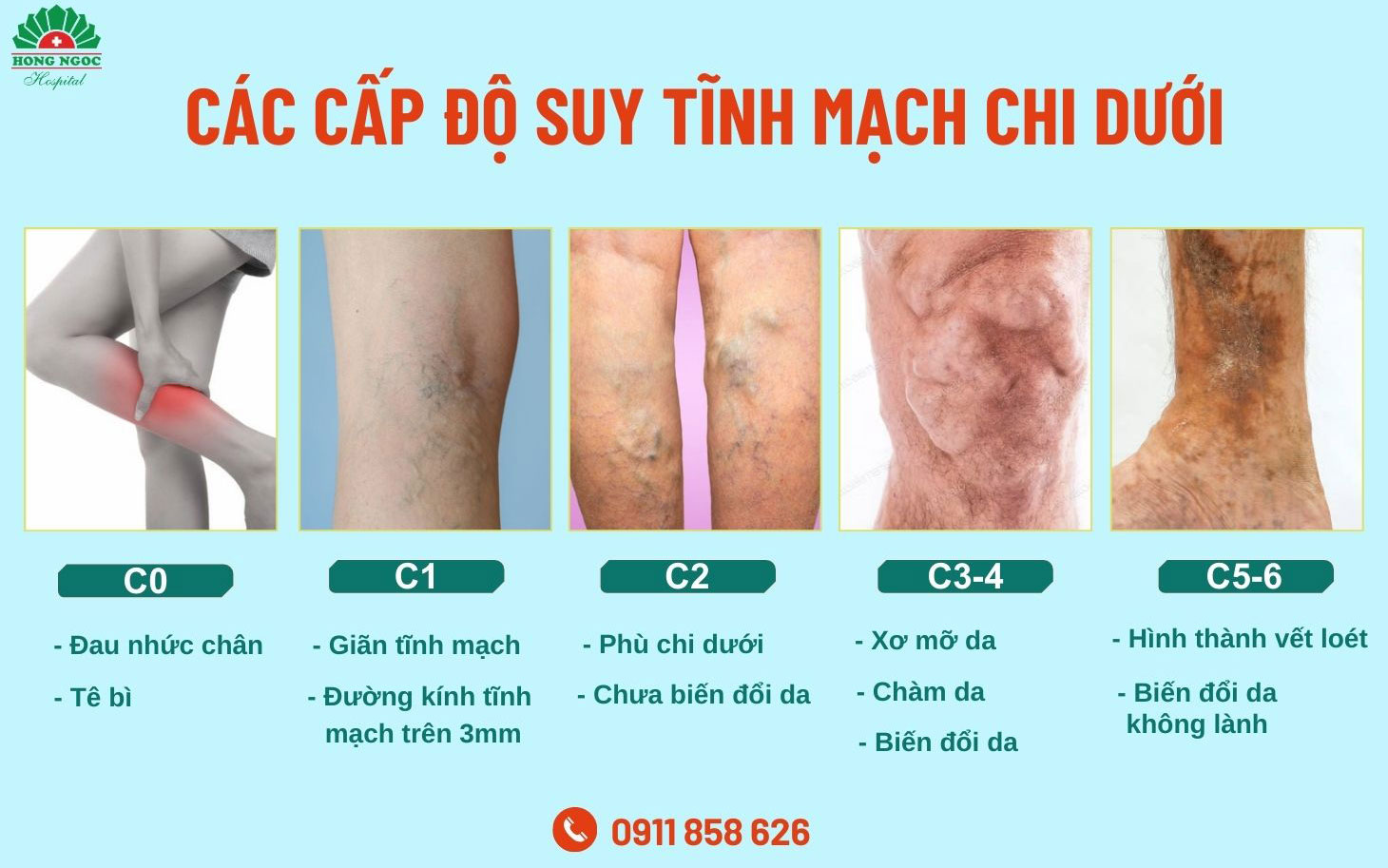 Cap Do Suy Tinh Mach