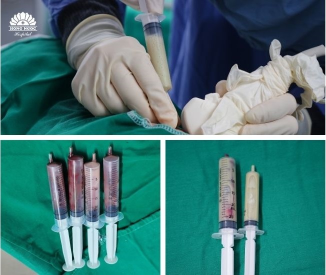 chum-ap-xe-gan-khong-lo-gay-nhiem-khuan-huyet