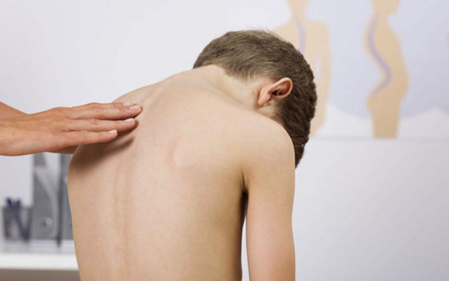 Dị tật bẩm sinh