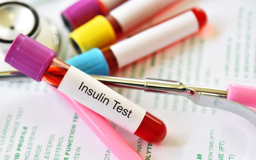 Bác sĩ sẽ cá thể hóa xét nghiệm kháng insulin theo từng bệnh nhân
