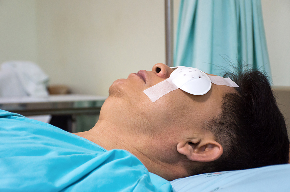 Để bảo vệ giác mạc trong giai đoạn hồi phục đầu tiên (1 - 2 tuần), việc sử dụng kính bảo vệ mắt (eye shield) là yêu cầu bắt buộc, áp dụng trong mọi thời điểm kể cả khi ngủ