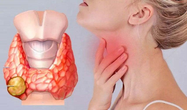 Phụ nữ trung niên thường dễ mắc bệnh tuyến giáp cần theo dõi và khám định kỳ để phát hiện và điều trị bệnh kịp thời