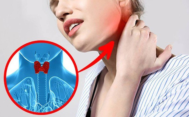 Những bệnh lý tuyến giáp thường gặp