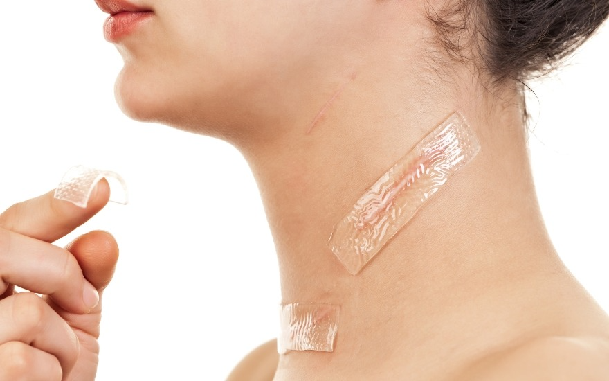 Tấm silicone trị sẹo không dùng lên vết thương hở
