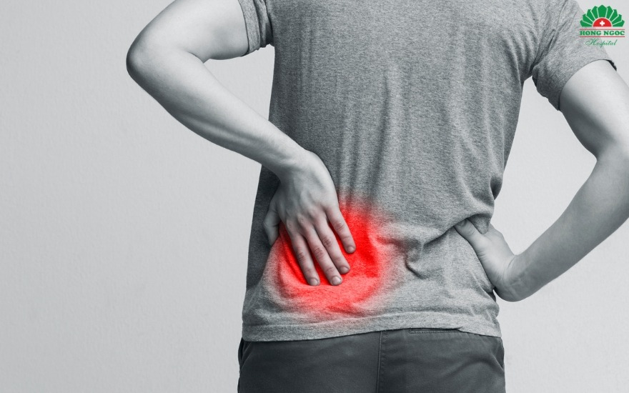 Sỏi dễ bị nhầm thành đau lưng