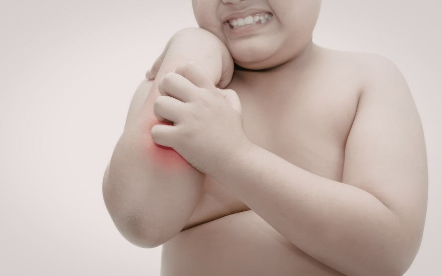 Béo phì có yếu tố di truyền