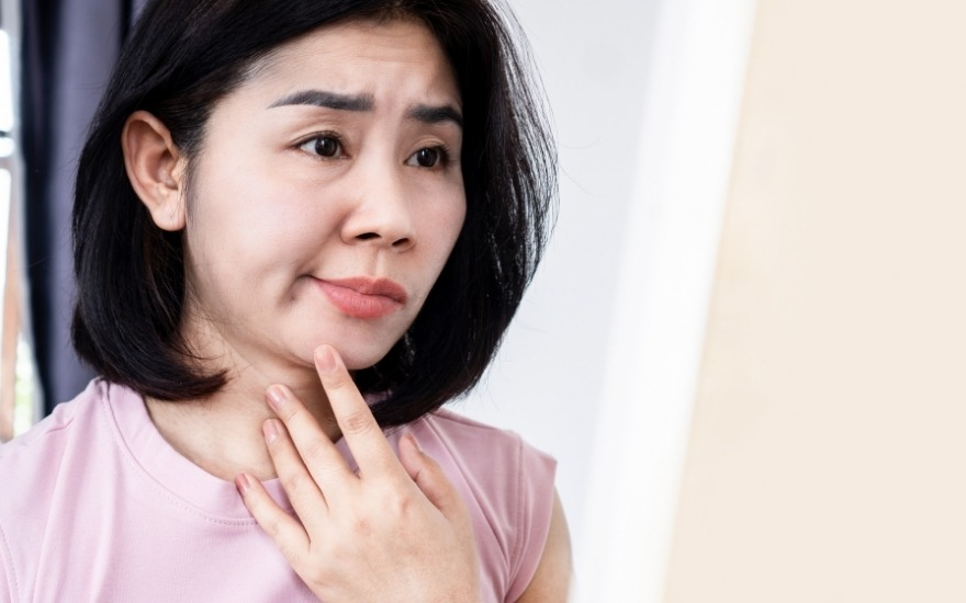 Méo miệng là dấu hiệu dễ nhận biết của đột quỵ