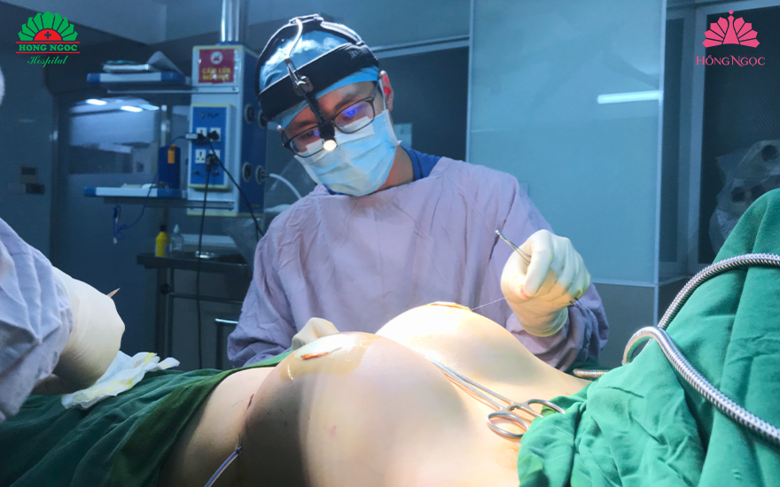 nâng ngực nội soi