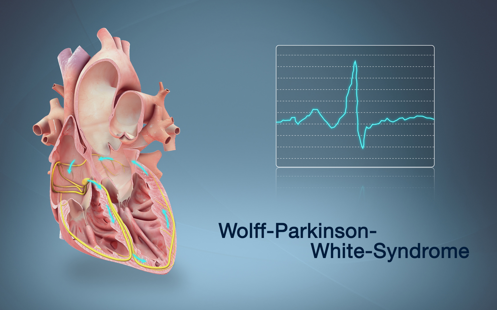 Nhip Nhanh Kich Phat Tren That