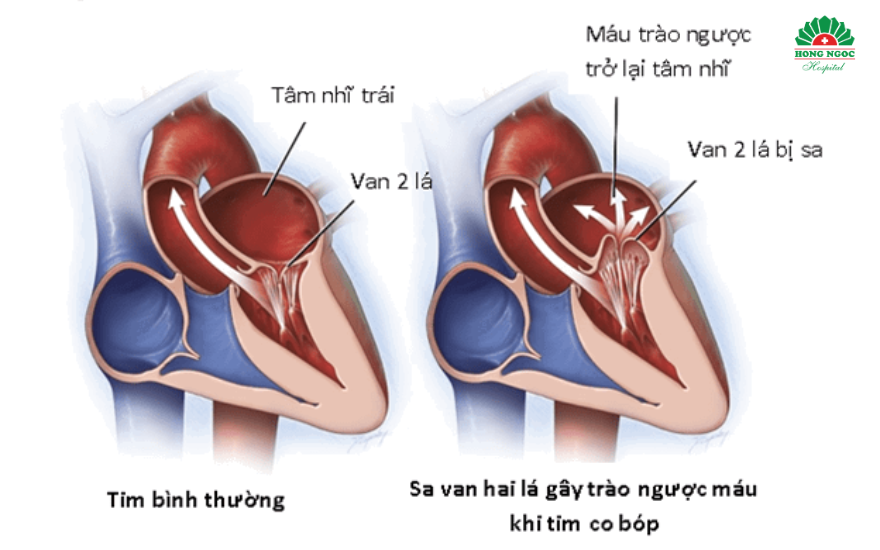 Sa Van Hai La