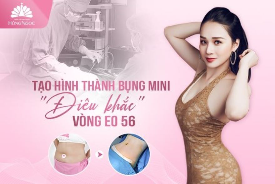 tạo hình thành bụng