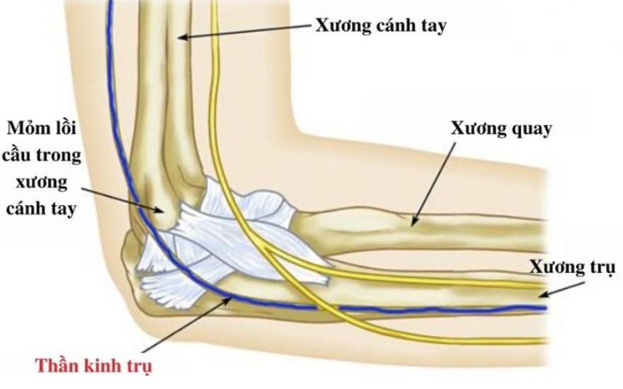 tổn thương thần kinh trụ
