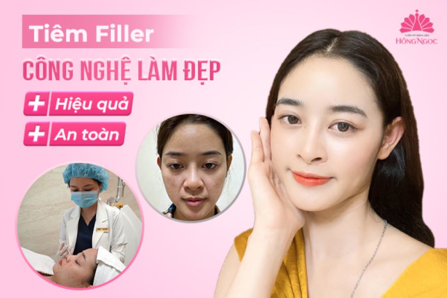 tiêm Filler