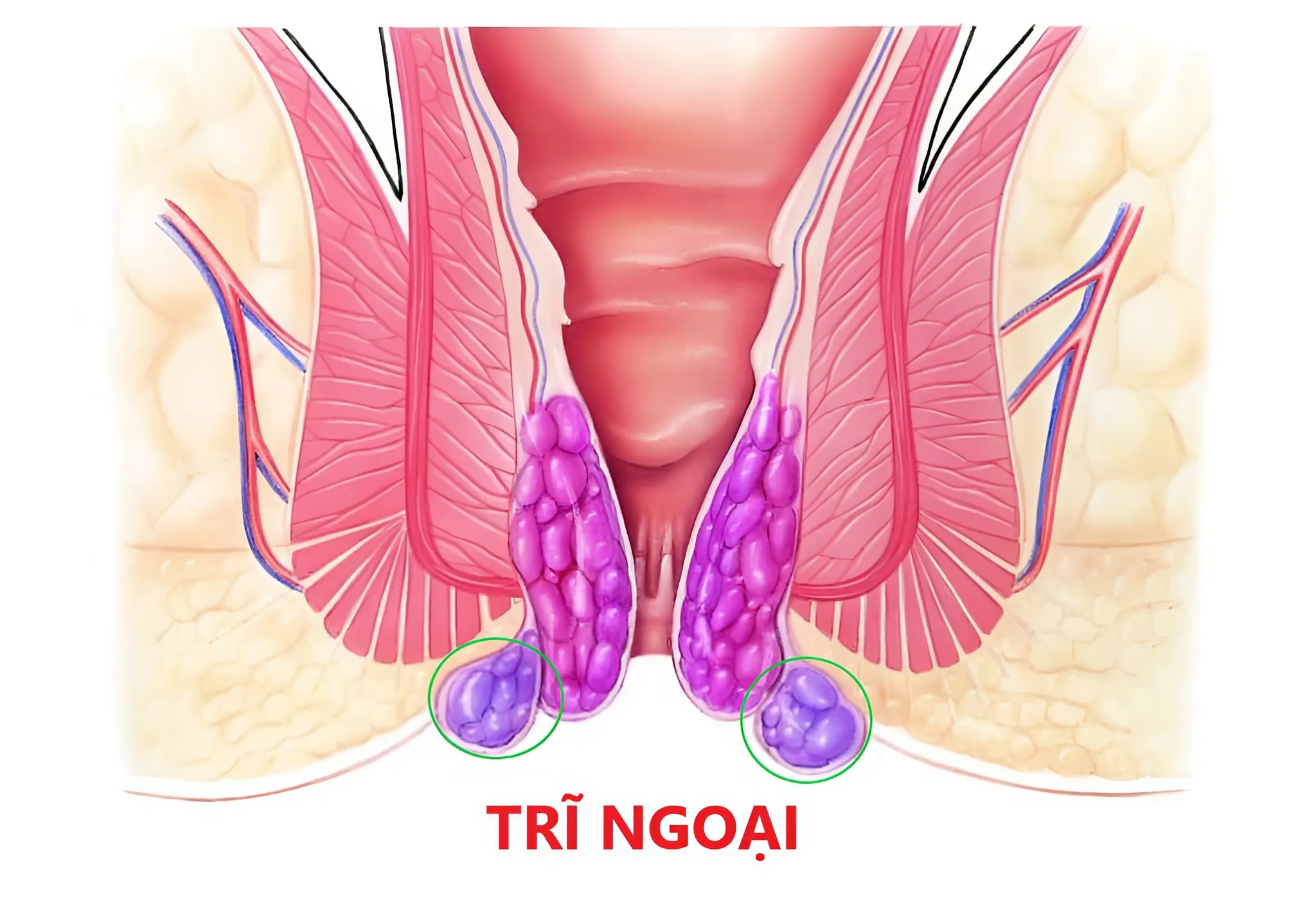 tri-ngoai