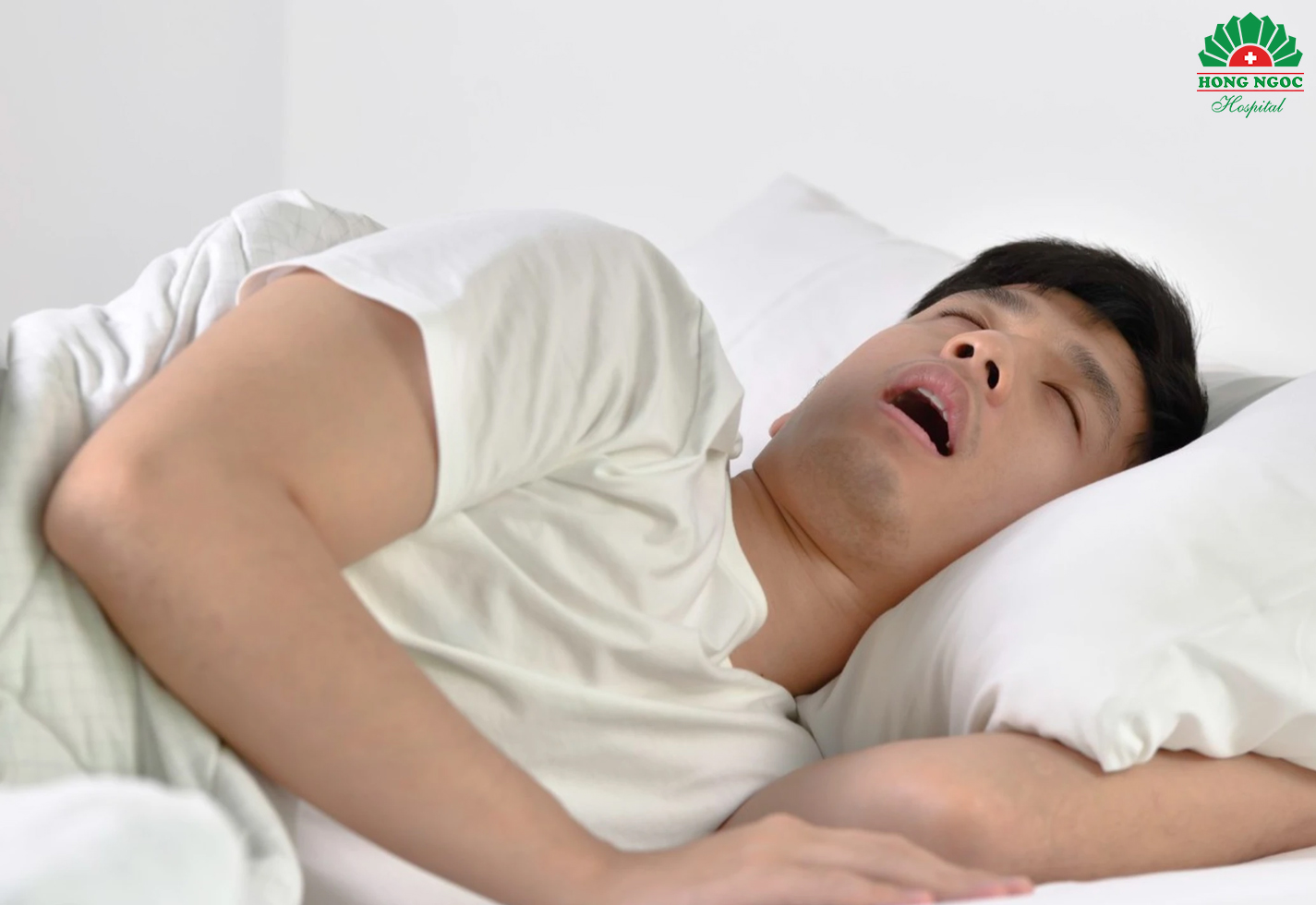 睡眠呼吸暂停