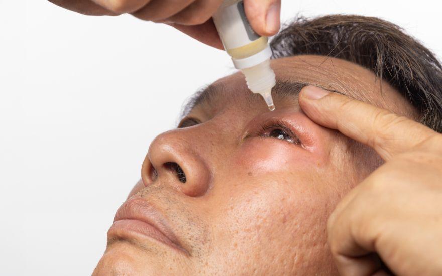 Nhóm thuốc chỉ chứa kháng sinh thuần túy thường được dùng để điều trị tình trạng viêm kết mạc hoặc lẹo mắt.
