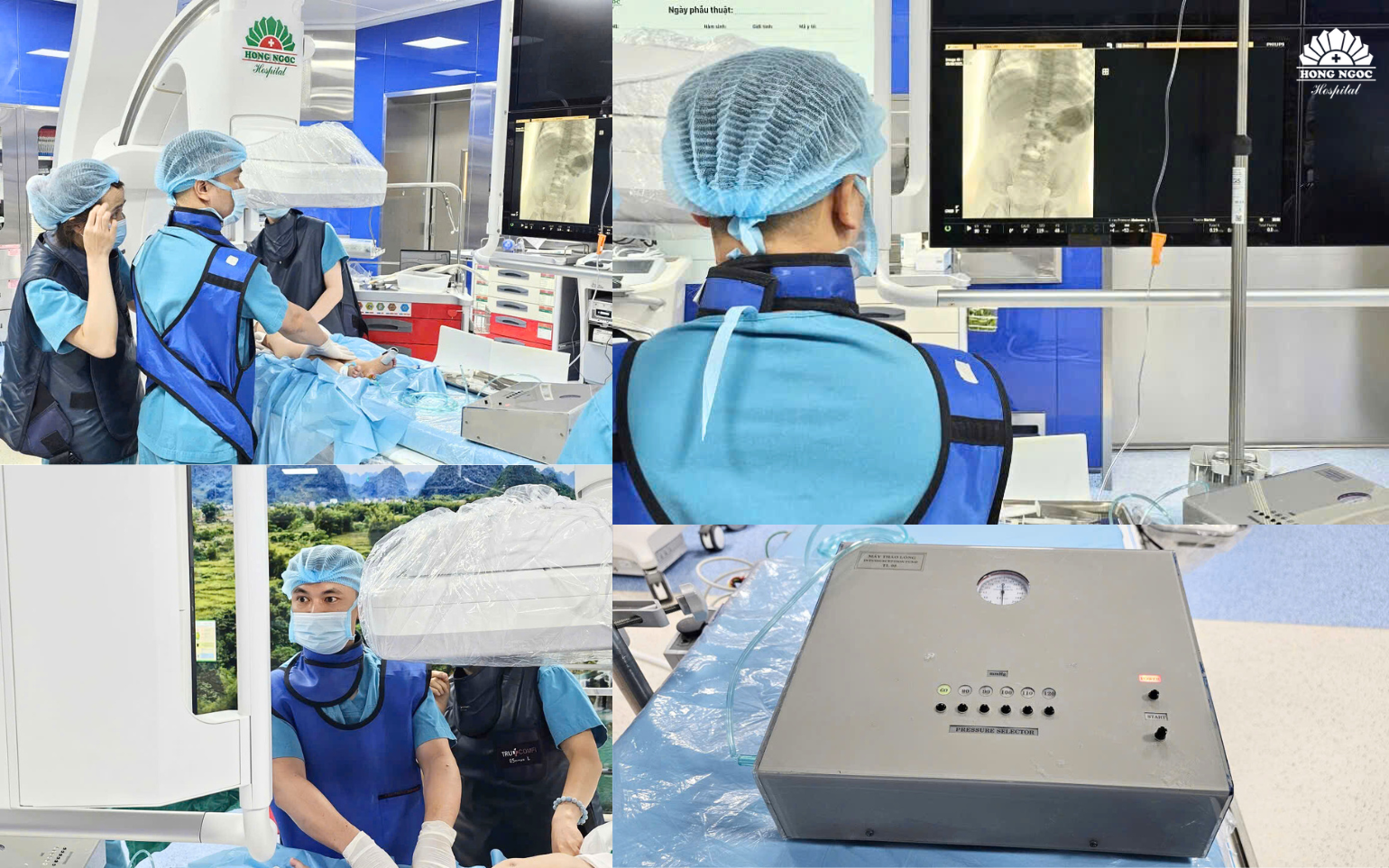 Lồng ruột ở trẻ em