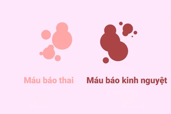 ra máu khi mang thai
