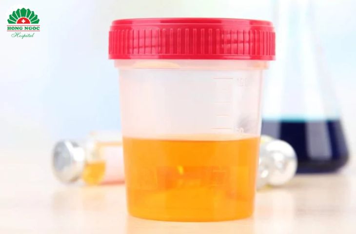 viêm tuyến tiền liệt có tự khỏi không