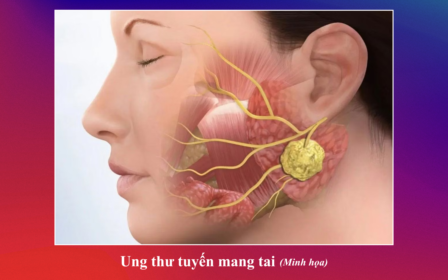 Ảnh 1