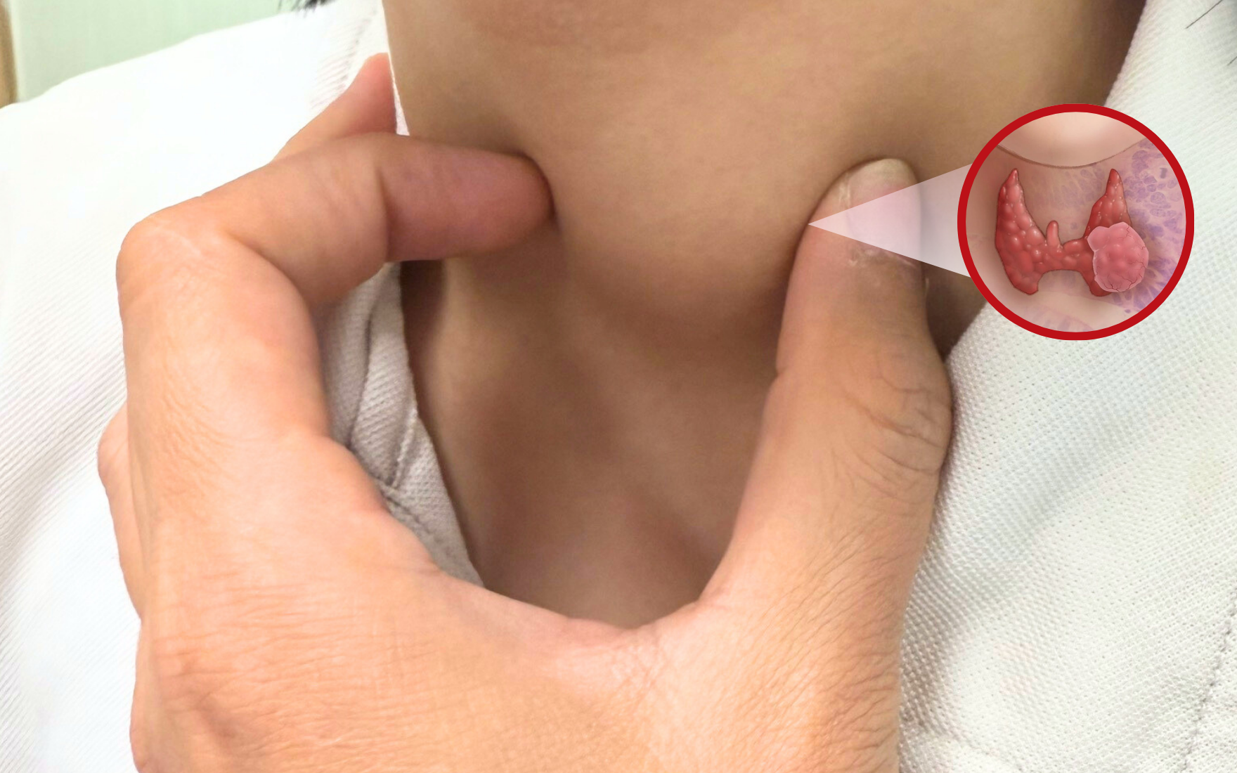 Anh 1   Thumb