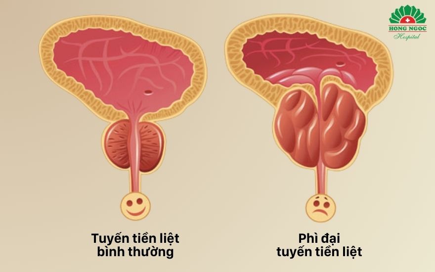 Tang Sinh Tuyen Tien Liet 001