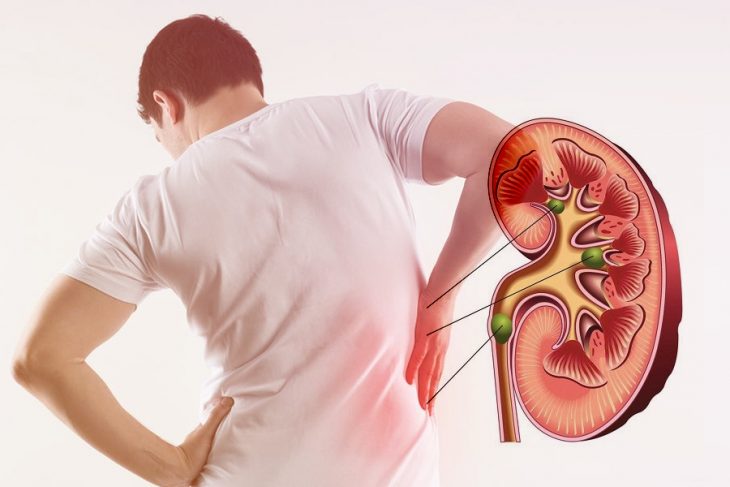 cấm kỵ khi ăn dưa hấu