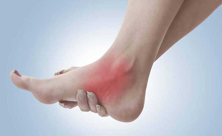 bệnh khớp charcot