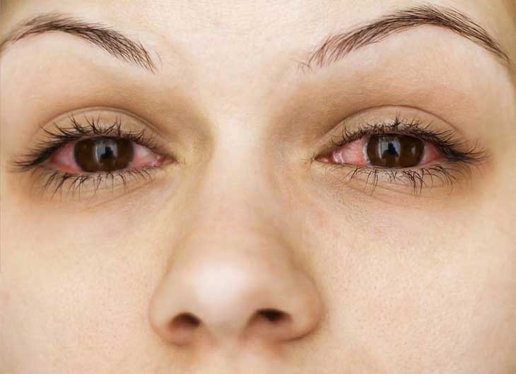 Biến chứng đái tháo đường