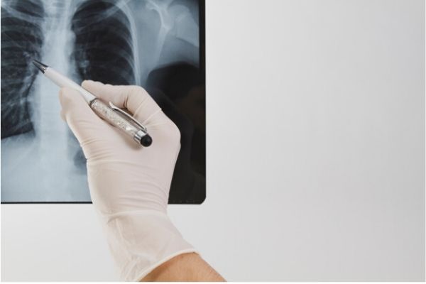 Mức độ ảnh hưởng của tia X đến thai nhi