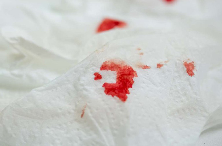 Đi ngoài ra máu là biểu hiện của bệnh gì? Khắc phục như thế nào?