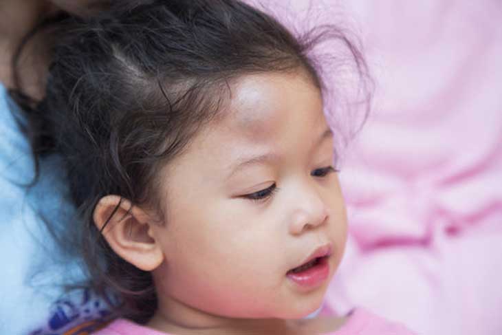 Dấu hiệu còi xương