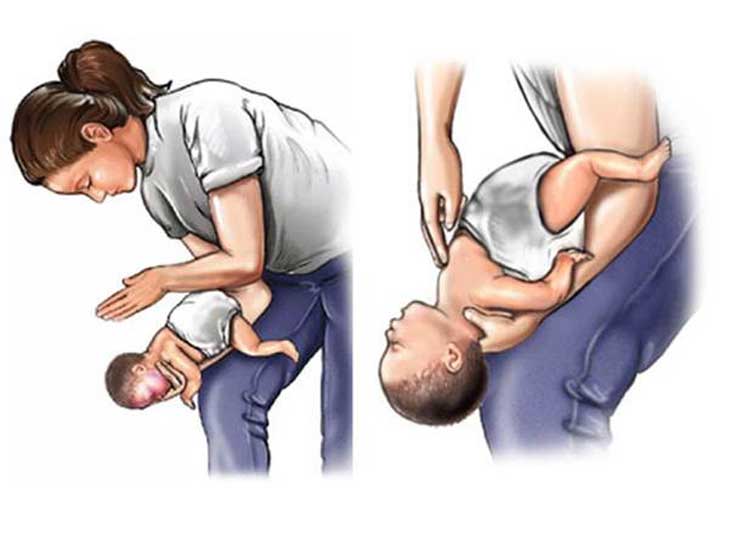 hít sặc ở trẻ em