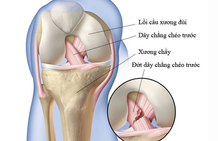 khớp gối