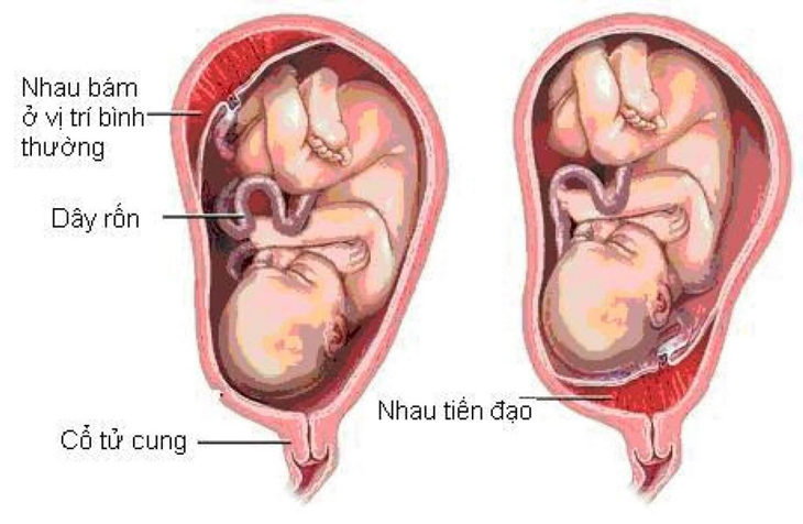 nhau tiền đạo