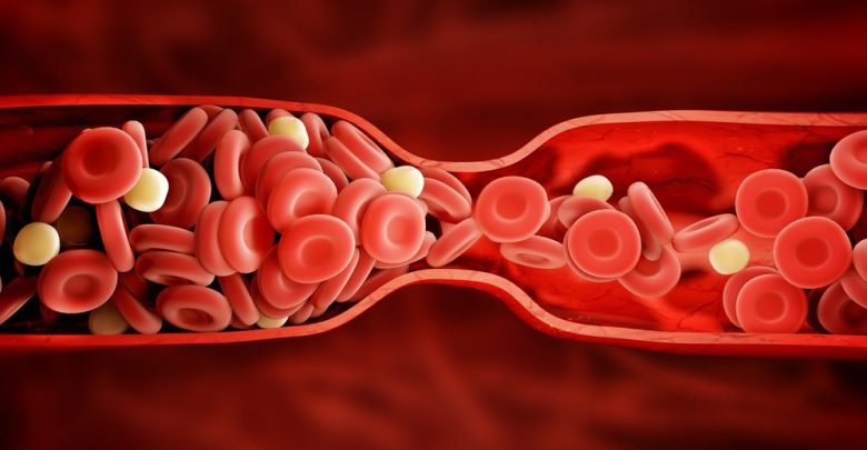 Cắt polyp đại tràng có đau không?