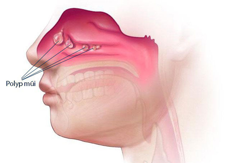  width=