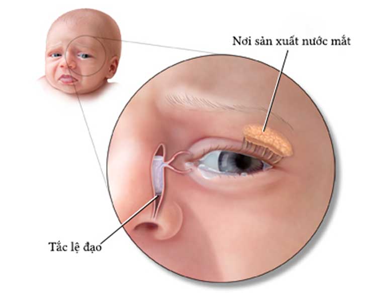 Tắc lệ đạo