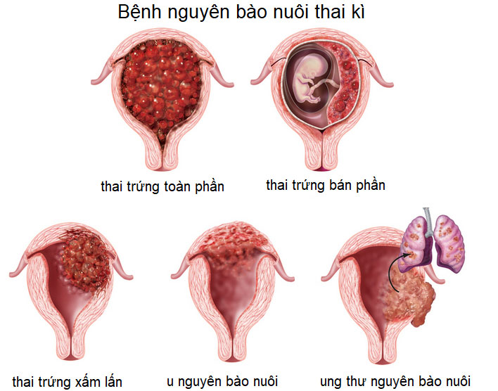 Thai trứng
