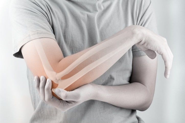 Trật khớp khuỷu tay