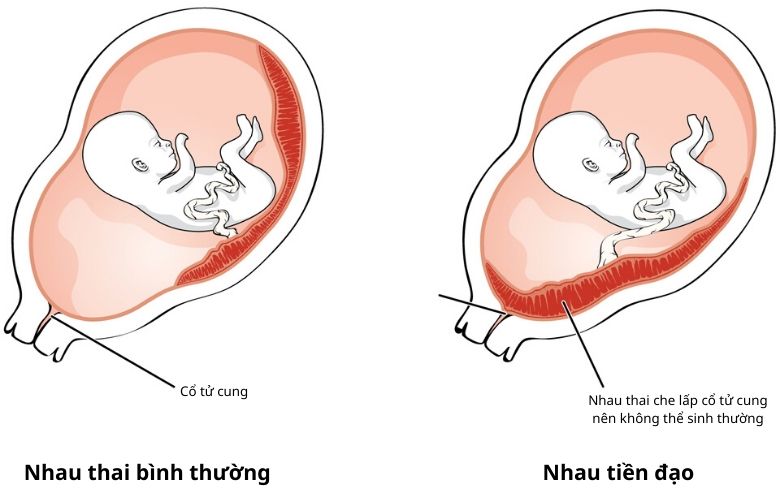 Tác hại của việc xoa bụng khi mang bầu sai cách&nbsp;