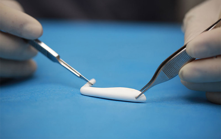 nâng mũi bằng silicon